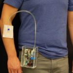 New Wearable Device Treats Antibiotic-Resistant Infections And Wounds wearables treat antibiotic resistant infections