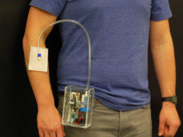 New Wearable Device Treats Antibiotic-Resistant Infections And Wounds wearables treat antibiotic resistant infections