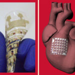 Researchers Develop Flexible Patch That Can Monitor and Treat Heart Disease Flexible patch monitors heart