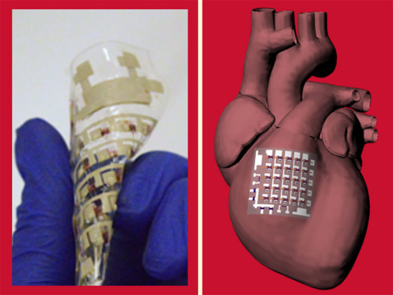 Flexible patch monitors heart