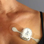 iRhythm’s Zio Wearable Patch Detects Previously Undiagnosed Atrial Fibrillation, Prevents Stroke iRhythm Zio mSToPS study result