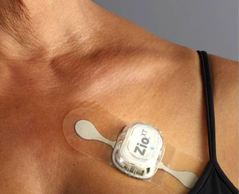 iRhythm Zio mSToPS study result