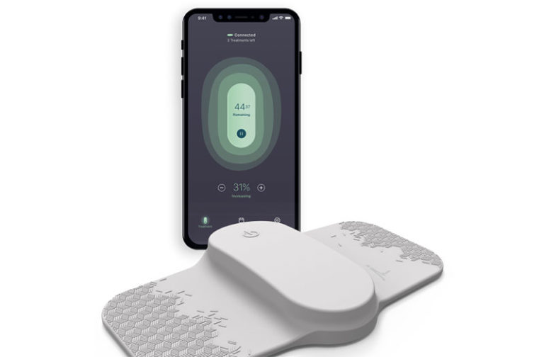 Nerivio Ren for treating migraine effective