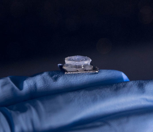 New Silicon-Based Lab-On-Chip Could Deliver Accurate Results Within Minutes TriSilix lab on chip diagnostic