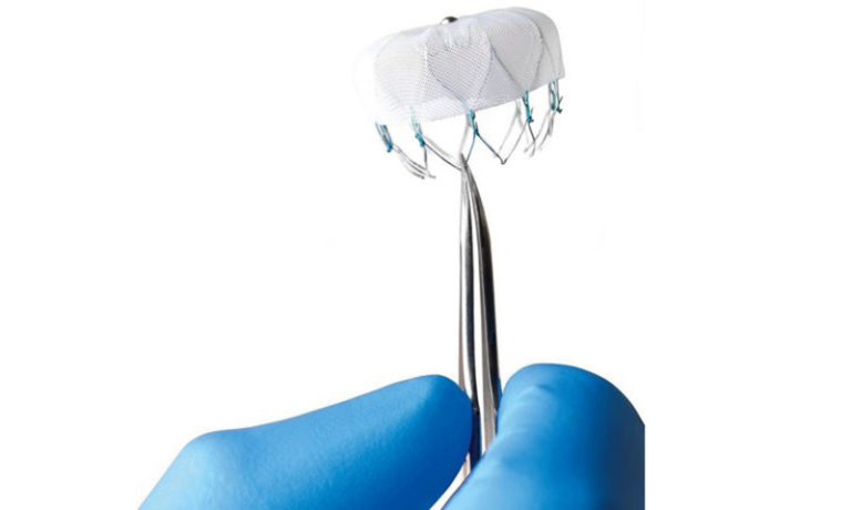 Boston Scientific buys Preventice