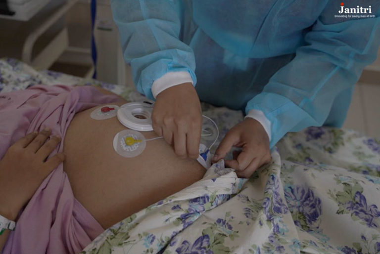 Janitri KEYAR wearable fetal heart rate monitor