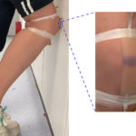 This Artificial Skin Bruises Like Real Skin, Could Be Used In Prosthetics and Robots To Sense Injuries Artificial Skin Bruises Like Real Skin