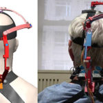 Robotic Neck Brace Helps Doctors Analyze Neck Mobility In Cancer Patients Columbia University robotic neck brace for cancer patients