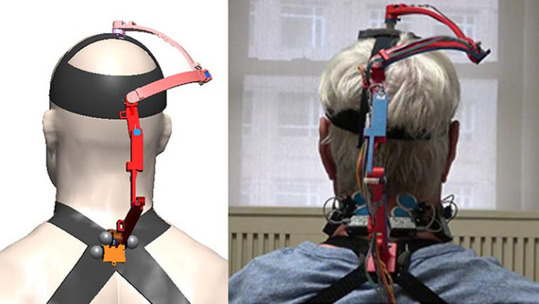 Columbia University robotic neck brace for cancer patients