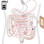 Scientists Develop Ingestible Robot That Delivers Insulin Without The Need For External Needles Ingestible Robot That Delivers Insulin