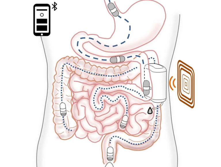 Ingestible Robot That Delivers Insulin