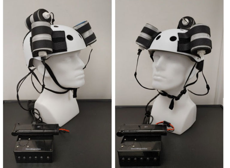 Oscillating magnetic helmet shrinks glioblastoma