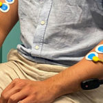 Finnish Researchers Develop Wearable Device to Assess Myoclonic Jerks Wearable device to assess myoclonic jerks