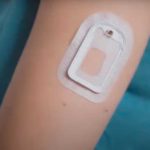 AMF Medical’s Sigi Wearable Insulin Management System Receives FDA Breakthrough Device Designation AMF Medical FDA Breakthrough Device Designation