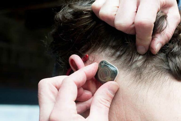 Epitel Closes 12.5 Million Dollars Series A Financing